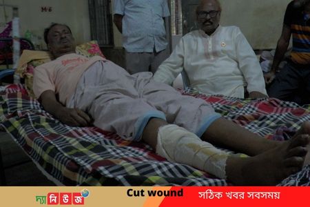 বালু উত্তোলনে বাঁধা দেয়ায় শিক্ষককে কুপিয়ে জখম