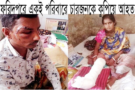 ফরিদপুরে হিন্দুকে কুপিয়ে আহত