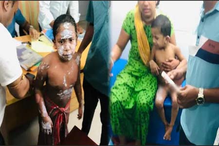 গ্যাস লিকেজ থেকে বিস্ফোরণে একই পরিবারের ৪জন দগ্ধ