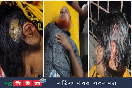 অর্কিত হামলায় নারীসহ আহত