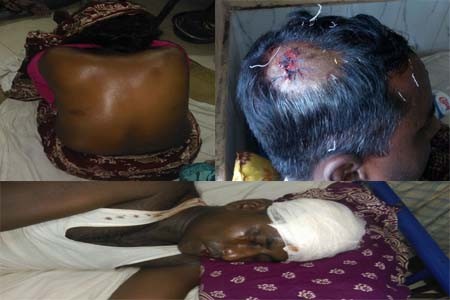 ভুমি দখলে বাধা দেওয়ায় হামলা