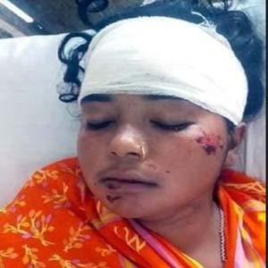 স্ত্রীকে মারপিট করে রক্তাক্ত