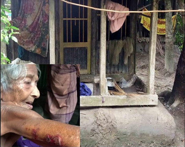 আগৈলঝাড়ায় ভাতার টাকা ও খাবার খেতে চাওয়ায় পূত্রবধূর হাতে চরম নির্যাতনের শিকার শাশুড়ি