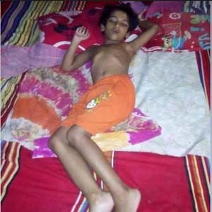 প্রতিবন্ধী নাতিশাকে বাঁচাতে প্রয়োজন দেড় লক্ষ টাকা, সাহায্যের আবেদন দরিদ্র পিতার 