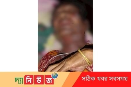 অপচিকিৎসায় মৃত্যুর সাথে পাঞ্জা লড়ছেন