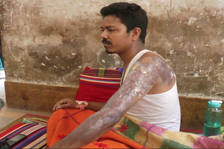 হাত ঝলসে দিলো পুলিশ