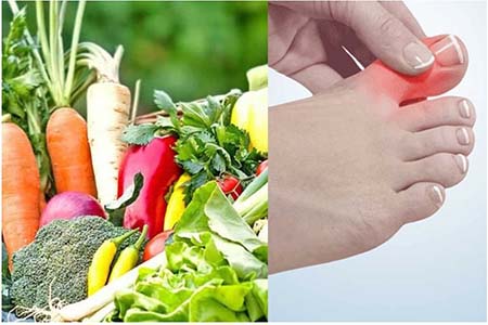 ইউরিক অ্যাসিড কমাতে