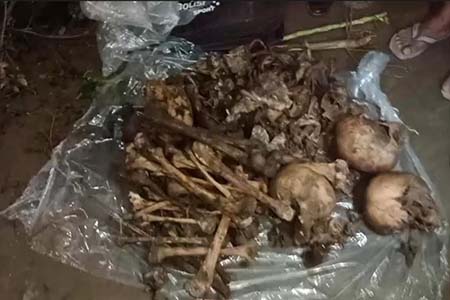দেবীগঞ্জে ৪টি কঙ্কাল উদ্ধার