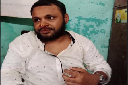অধ্যক্ষের ঘুষিতে নাক ফাটলো শিক্ষকের