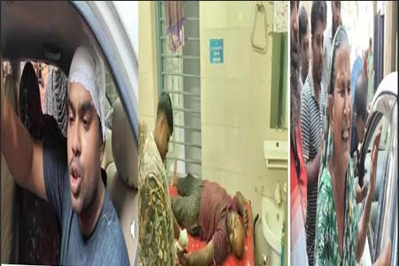 দুই জনের অবস্থা আশংকাজনক