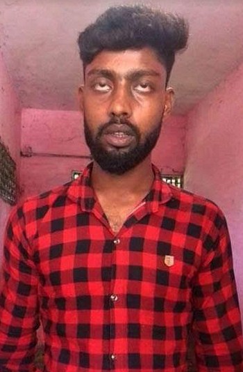 শার্শায় মাদক কেনা-বেচাকে কেন্দ্র করে সংঘর্ষ, হাঁসুয়ার কোপে শিশু জখম