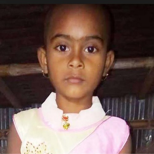 শৈলকুপায় বিষধর সাপের কামড়ে শিশুর মৃত্যু