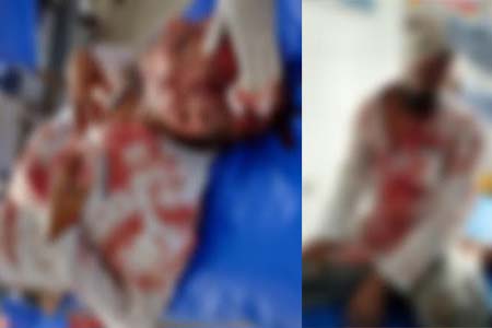 ভাই ও ভাবীকে এলোপাথারি কুপিয়ে জখম