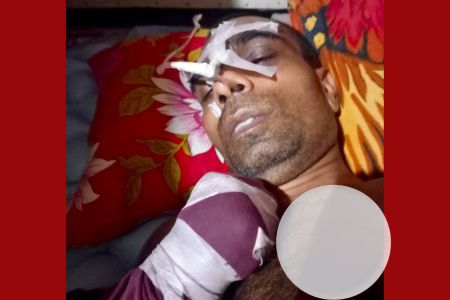 চাঁদার দাবিতে হাতুড়িপেটা, ৫ মাস পর মৃত্যু, অভিযুক্ত রাজু মেম্বার এখনো অধরা