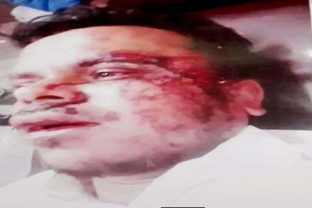 ছাতকে প্রতিপক্ষের হামলায় কৃষক আহত