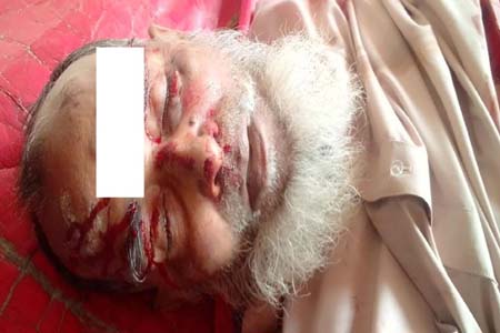 ঝিকরগাছায় ট্রেনে কাটা পড়ে বৃদ্ধ নিহত