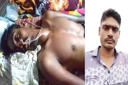বেনাপোলে দিনমজুর দুঃখু মিয়াকে বাঁচাতে সাহায্যের হাত বাড়িয়ে দিন