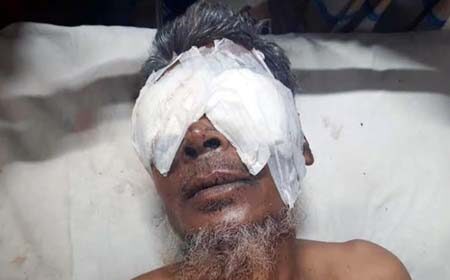 দুই চোখ উপরে ফেলেছে