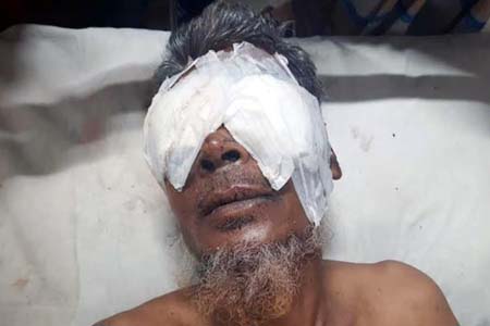দুই চোখ উপরে ফেলেছে
