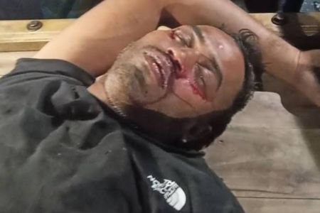 মোটরসাইকেল চোরকে আটকে গণধোলাই