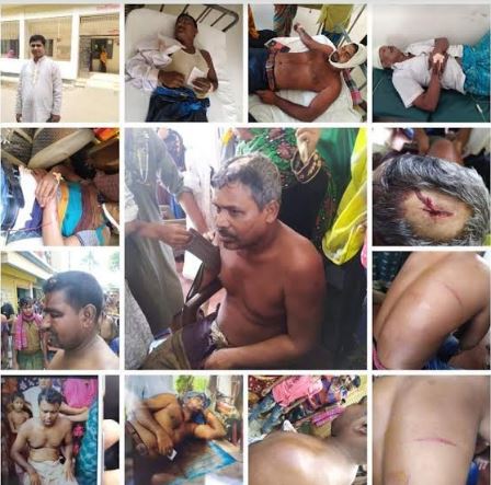শার্শা গোগা ইউনিয়ন চেয়ারম্যান প্রার্থীকে কেন্দ্র করে সন্ত্রাসী হামলা, আহত ৫০