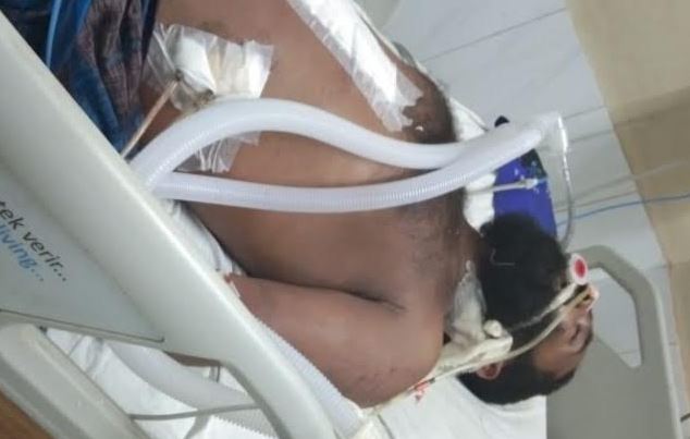 কালীগঞ্জে পূর্ব শত্রæতার জেরে প্রতিপক্ষের হামলায় আহত আল ইসলামের মৃত্যু
