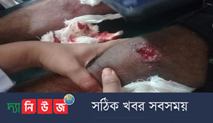 নোয়াখালীতে ছাত্রলীগ কর্মি গুলিবিদ্ধ