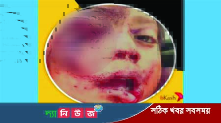 সামিয়াকে বাঁচাতে সাহায্যের হাত বাড়িয়ে দিন