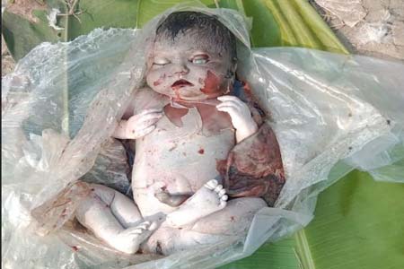 নবজাতকের মরদেহ