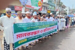 শিক্ষক নেতা দেলোয়ার হোসেন আজিজীর হয়রানির প্রতিবাদে ঝিনাইদহে মানববন্ধন