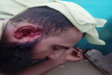 কুপিয়ে জখম