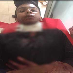 প্রেমে সাড়া না পেয়ে নিজের গলায় ছুরি