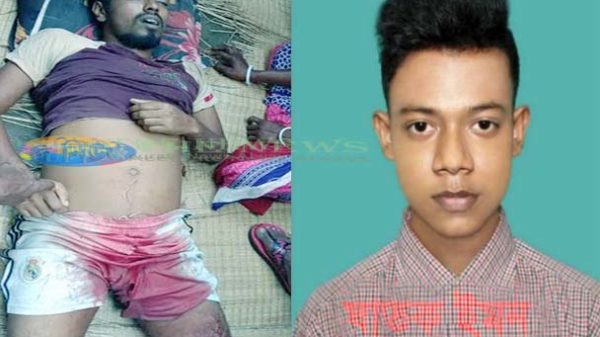 গোপনাঙ্গ কুপিয়ে খুন