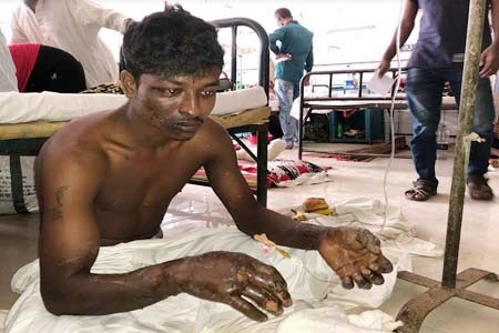 স্ত্রীর গায়ে আগুন ধরিয়ে
