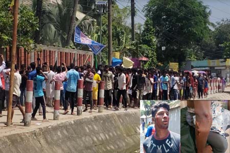 নিকলীতে বিক্ষোভ মিছিলে ৪ জন গুলিবিদ্ধ