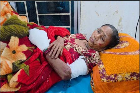 ককটেল বিস্ফোরণে এক নারী আহত