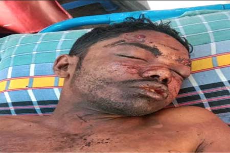 ককটেল বিস্ফোরণে যুবক আহত