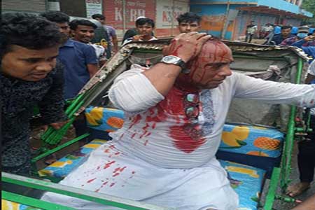 নেতার মাথা ফাটালেন ছাত্রলীগ নেতা