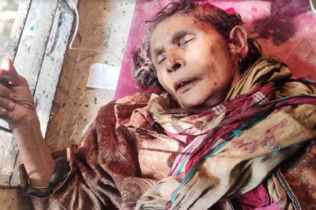 বাবা-মাকে পিটিয়ে ও কুপিয়েছে পাষন্ড ছেলে