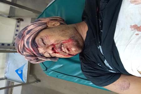 সংঘর্ষে প্রবাসীর মৃত্যু  