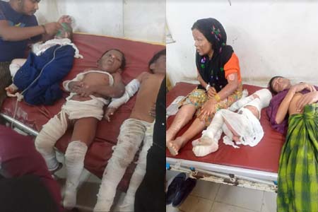 রোহিঙ্গা ক্যাম্পে গ্যাস সিলিন্ডার বিস্ফোরণ