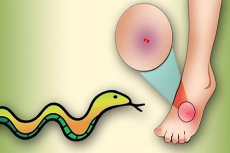 সাপের কামড়ে গৃহবধূর মৃত্যু