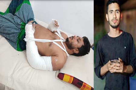 শিক্ষকের দুই হাত ভেঙ্গে দিল কিশোর গ্যাং