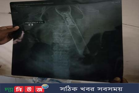 নোয়াখালীতে বৃদ্ধের পায়ু পথে টর্চলাইট ঢুকিয়ে নির্যাতন