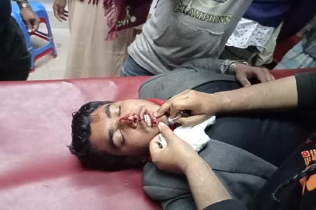 টিভি ক্যামেরাপার্সন আহত