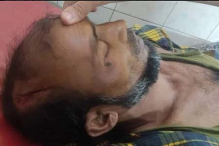 ভাতিজার লাঠির আঘাতে চাচার মৃত্যু