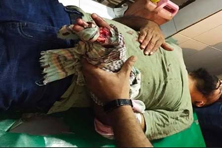 স্বেচ্ছাসেবকলীগ নেতাকে কুপিয়ে জখম