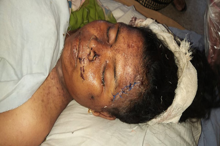 পত্নীতলা স্বাস্থ্য কমপ্লেক্সে চিকিৎসাধীন অবস্থায় অজ্ঞাত নারীর মৃত্যু