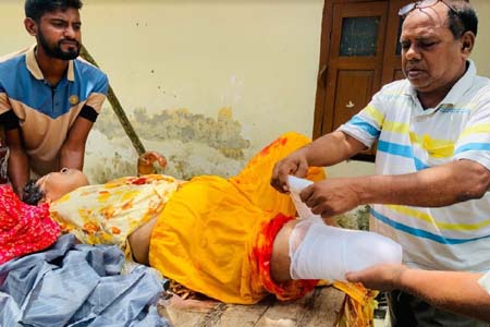 নারীর এক পাঁ বিচ্ছিন্ন