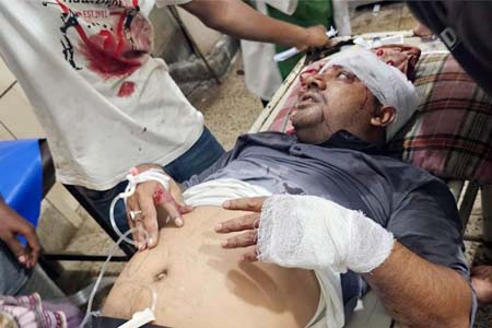 ছাত্রলীগ সভাপতিকে কুপিয়ে হত্যা চেস্টা